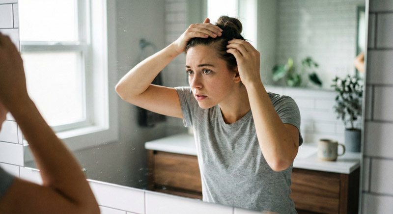 Hair Thinning at 25: Why It’s Happening and What to Do