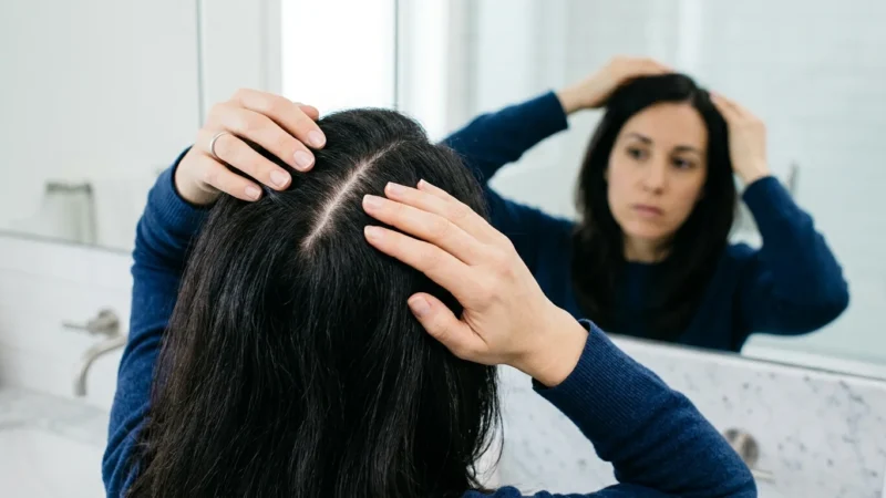 Seborrheic Dermatitis vs Dandruff: How to Tell the Difference